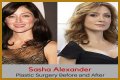 Sasha Alexander Plastic Surgery Before and After